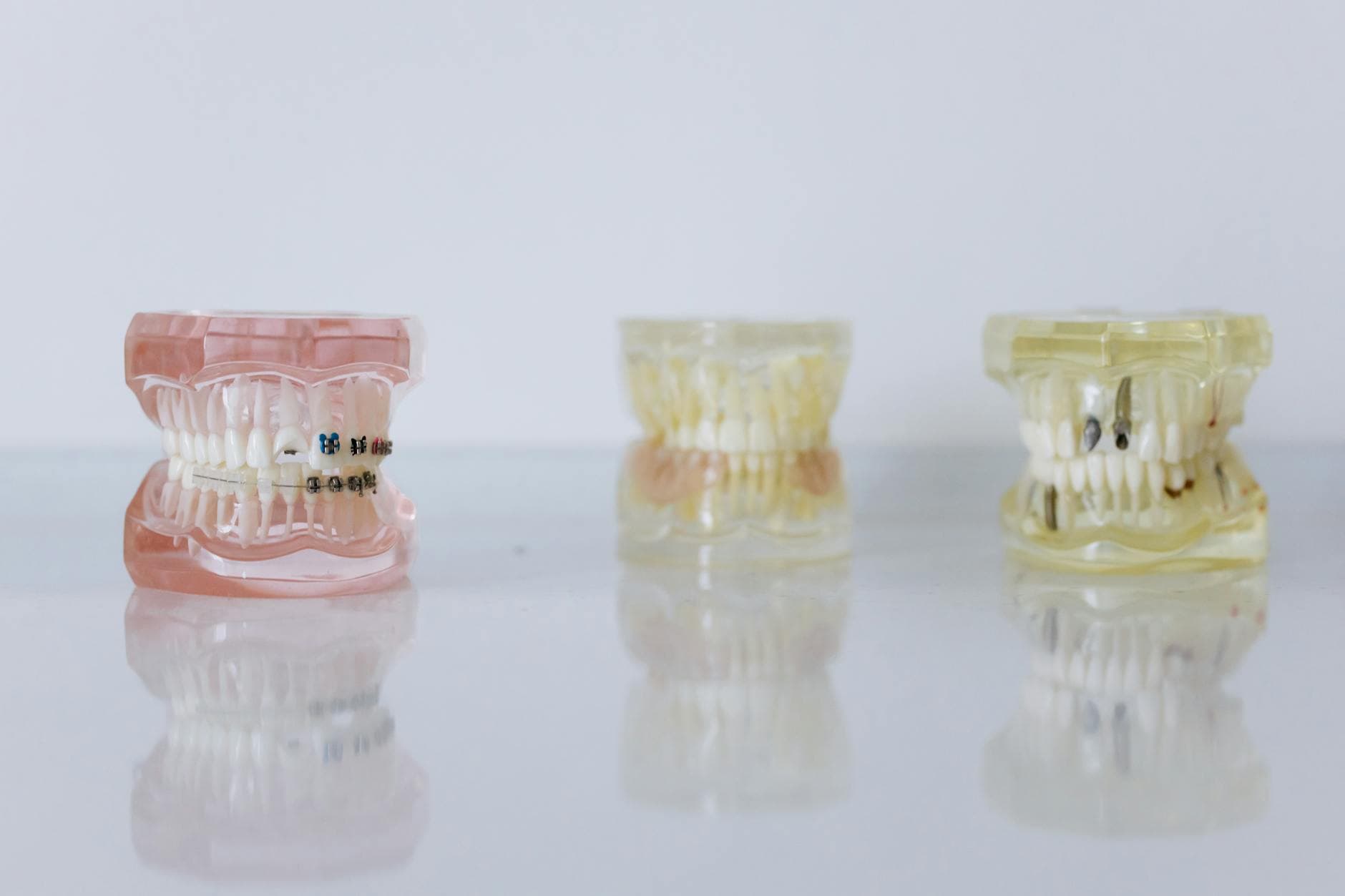 Orthodontics braces aligners CBD Belapur dental models treatment