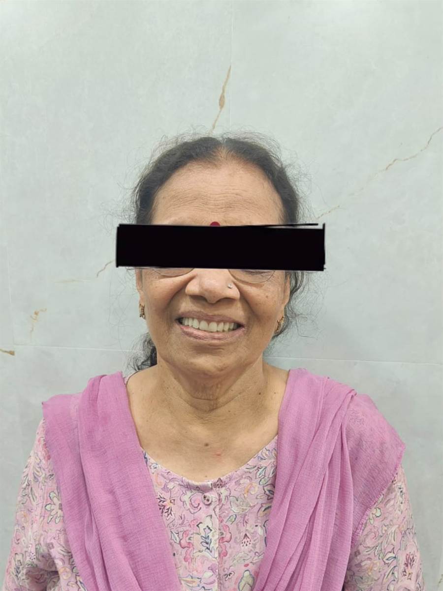 Complete dentures Belapur after treatment — patient with new complete dentures fitted