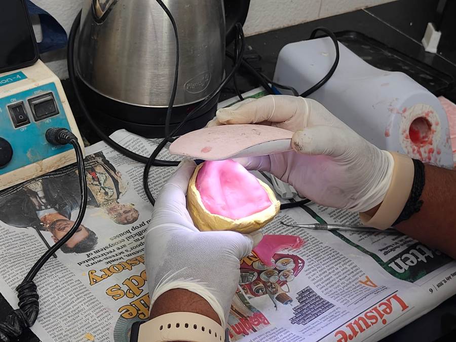Dental lab technician processing a complete denture chairside at Dr. Wendy's Dental Clinic, CBD Belapur